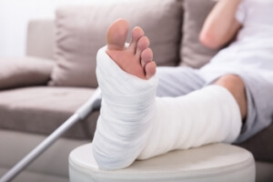 Did I Break My Foot?