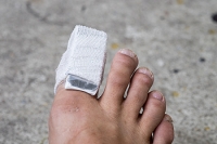 Are Broken Toes a Serious Condition?