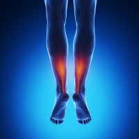 Understanding an Achilles Tendon Rupture