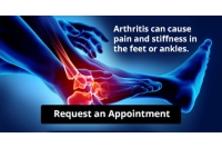 Arthritis Can Cause Pain in the Feet and Ankles