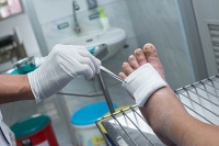 An Overview of Diabetic Foot Ulcers