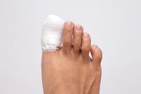 Treating a Broken Toe