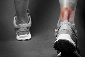 What Is an Achilles Tendon Tear?