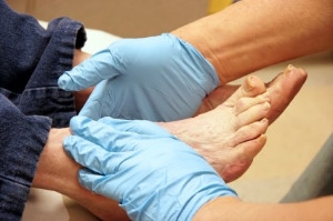 Caring for Your Feet With Diabetes