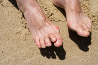 Types of Arthritis That Can Affect The Feet