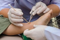 Taking Care of Minor Foot Wounds In Diabetics