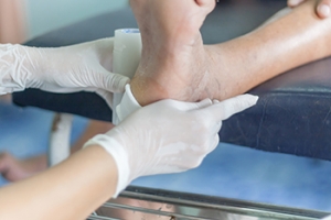 Prioritizing Foot Wound Care for Better Health and Mobility