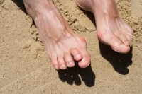 Which Toes Are Generally Affected by Hammertoe?