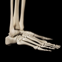 What are Stress Fractures and Ways to Prevent Them