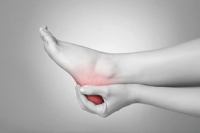 Heel Pain Can Affect More Than the Heel